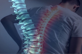 Omurga Kırığı: Modern ve Klasik Cerrahi Tedavi Yöntemleri