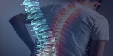 Omurga Kırığı: Modern ve Klasik Cerrahi Tedavi Yöntemleri