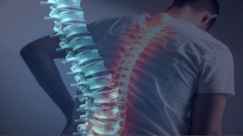 Omurga Kırığı: Modern ve Klasik Cerrahi Tedavi Yöntemleri